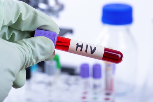 Test tube labeled HIV